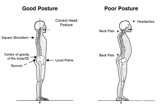 Good Posture and Bad Posture Diagrams
