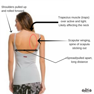 Annotated image of postural muscles